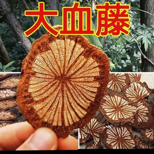 �t�ٴ�؛���l�o��o�����ݲ��ݾ�ˮ�����tѪ�ٶ������l