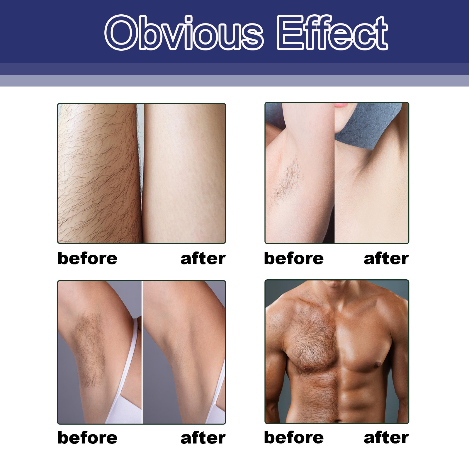 Hair Removal Spray Image 9