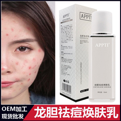 APPTI Gentian Acne treatment Whitening milk Manufactor Direct selling OEM machining OEM Dilute smallpox in India Shrink pores Repair milk