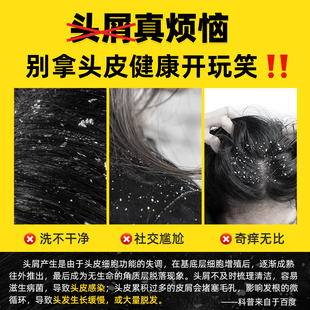 Grate Comb to Remove Dandruff, Ultra-Dense Fine-Tooth Comb to Shave Dandruff, Clean and Remove Head Lice, Encrypted Lice, Gold Small