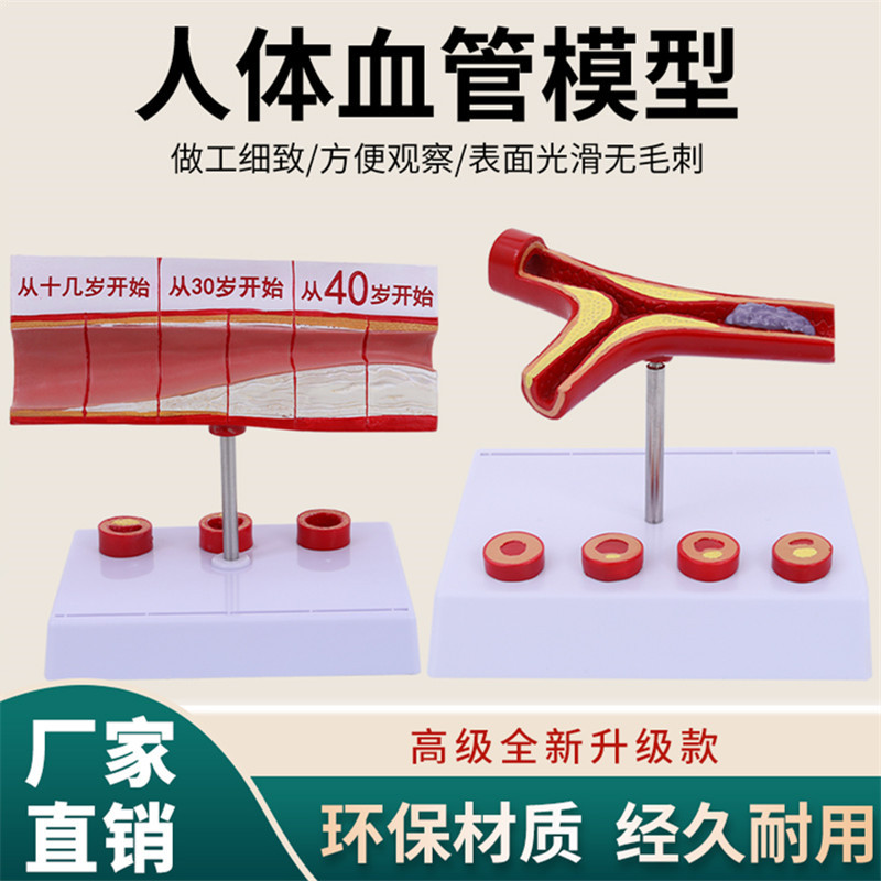 Modelo de la arteria coronaria Modelo de la arteria cardiovascular modelo de endurecimiento