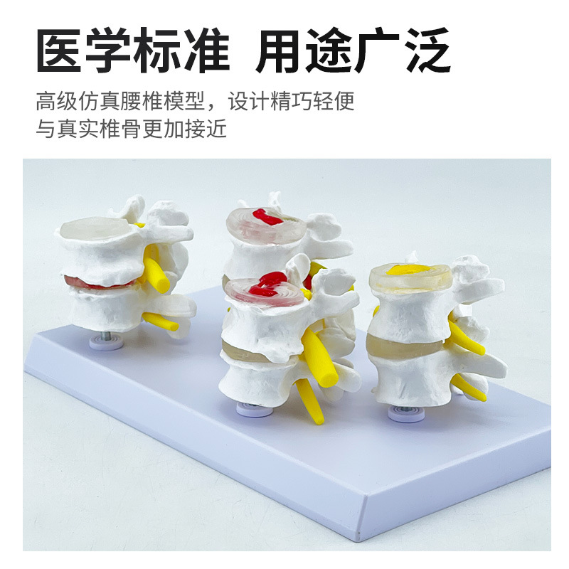 �ķ��ͼ�׵�����벡����׵���ģ�� ׵���̲�����׵��ʾ���� ����