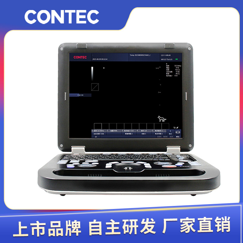 Kantai veterinario instrumento de diagnóstico de ultrasonido de imagen de ultrasonido de color animal portátil máquina de ultrasonido de color b fabricante