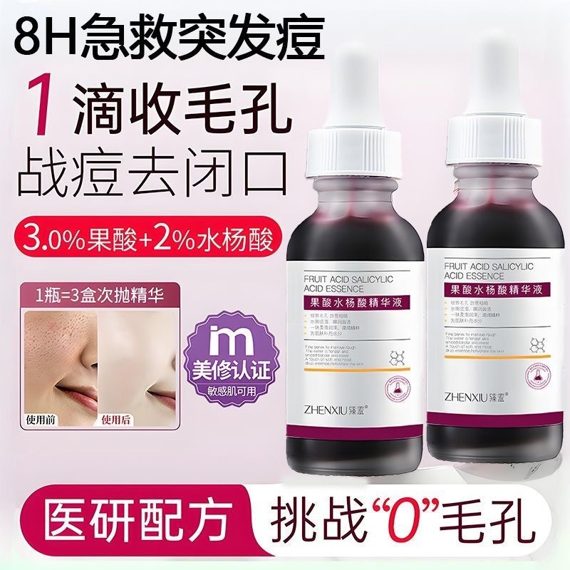 Zhenxiu フルーツ酸サリチル酸抗ニキビエッセンスはニキビを閉じ、ニキビ跡、黒ずみを閉じ、若返らせ、毛穴を縮小し、毛髪を生成します。|undefined