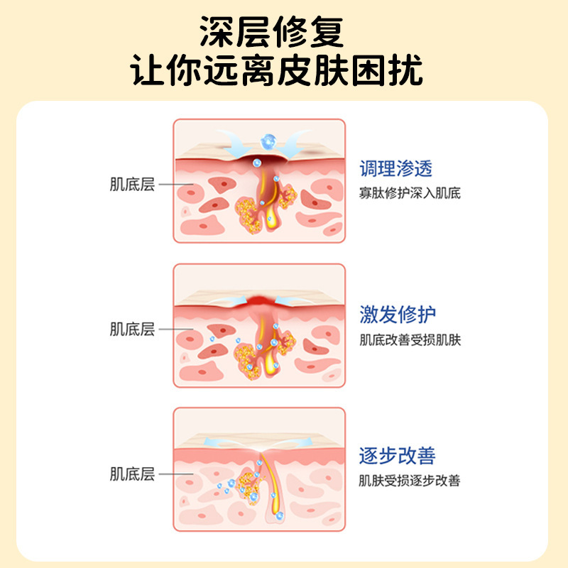 五毒止痒膏抑菌外用50g草本止痒乳膏工厂批发代发|undefined