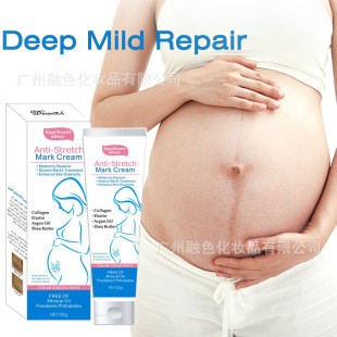 ���x�羳���w��Ǽy˪��ˬ����ā�̝�ȥ���L�yStretch mark cream