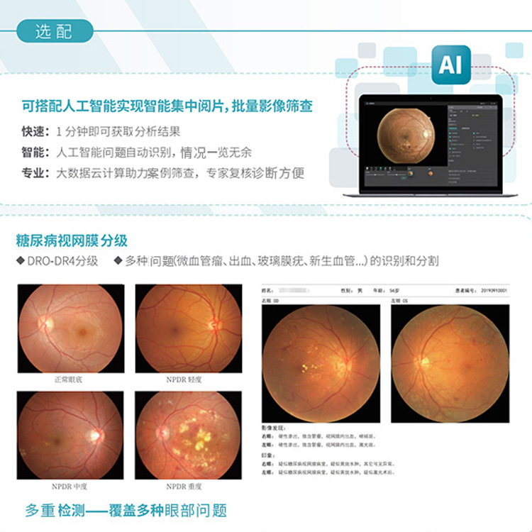 TNF300�����۵������  ����Ӱ��ɸ�� С�ɱ�� �����۵������