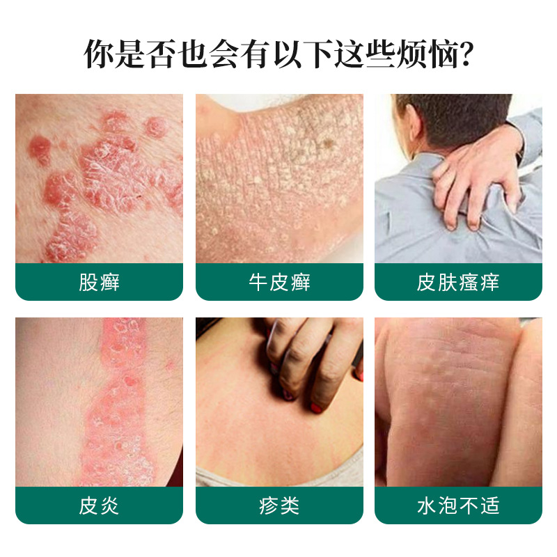 Yankang Medical Heat-Reduction Gel 20g, Skin Itching, Eczema, Rash, Tinea, Blister Discomfort, Ointment, Wholesale