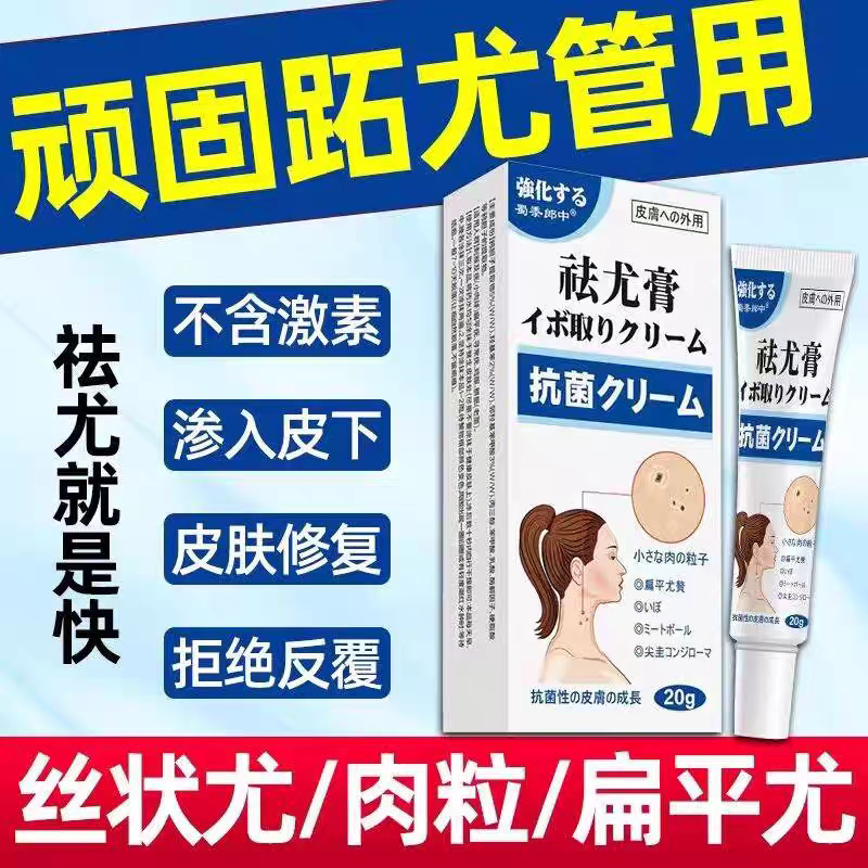 首に長く生えたカササギの疣、足の疣、猿の疣、猿の目、鶏の目、肉粒、ニキビ、肉の棘|undefined