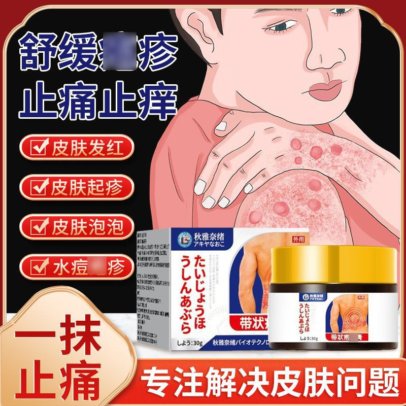 秋雅奈緒帯状泡疹クリーム30g皮膚泡疹が皮膚掻痒痛を緩和する外用保健クリーム|undefined