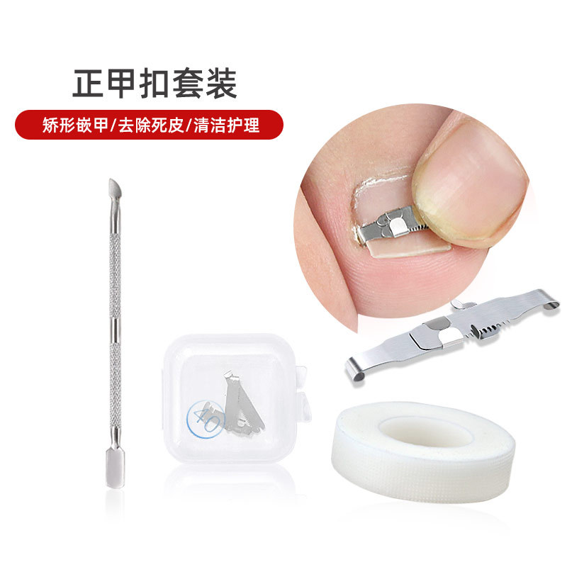 Toenail Groove Embedding Corrector, Nail Plate for Ingrown Toenails, Premium Toe Corrector and Stretcher