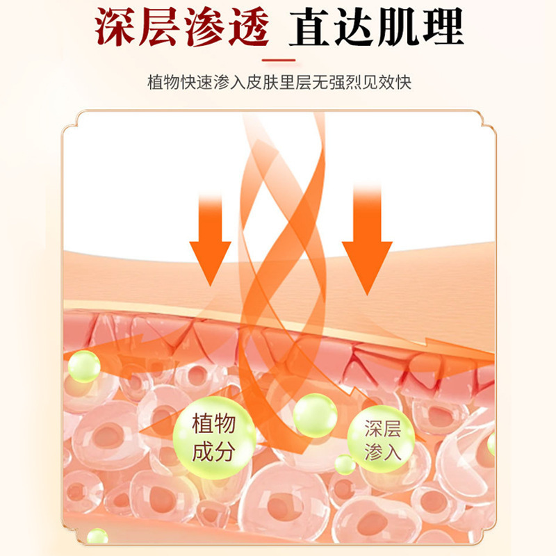 止痒膏断痒王 断痒膏手痒脚痒全身通用蚊虫叮咬止痒外用皮肤乳膏|undefined