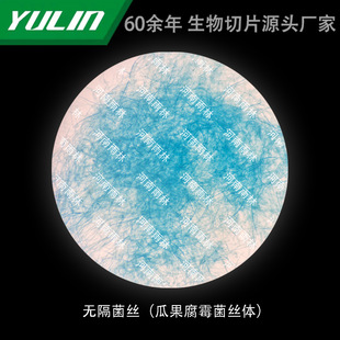 Non-septal mycelium (Melon Pythium mycelium) Histopathology paraffin slide specimen for medical college
