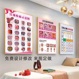 宫颈疾病示意图妇科宣传图子宫图片病变图广告女性生殖系统解剖图
