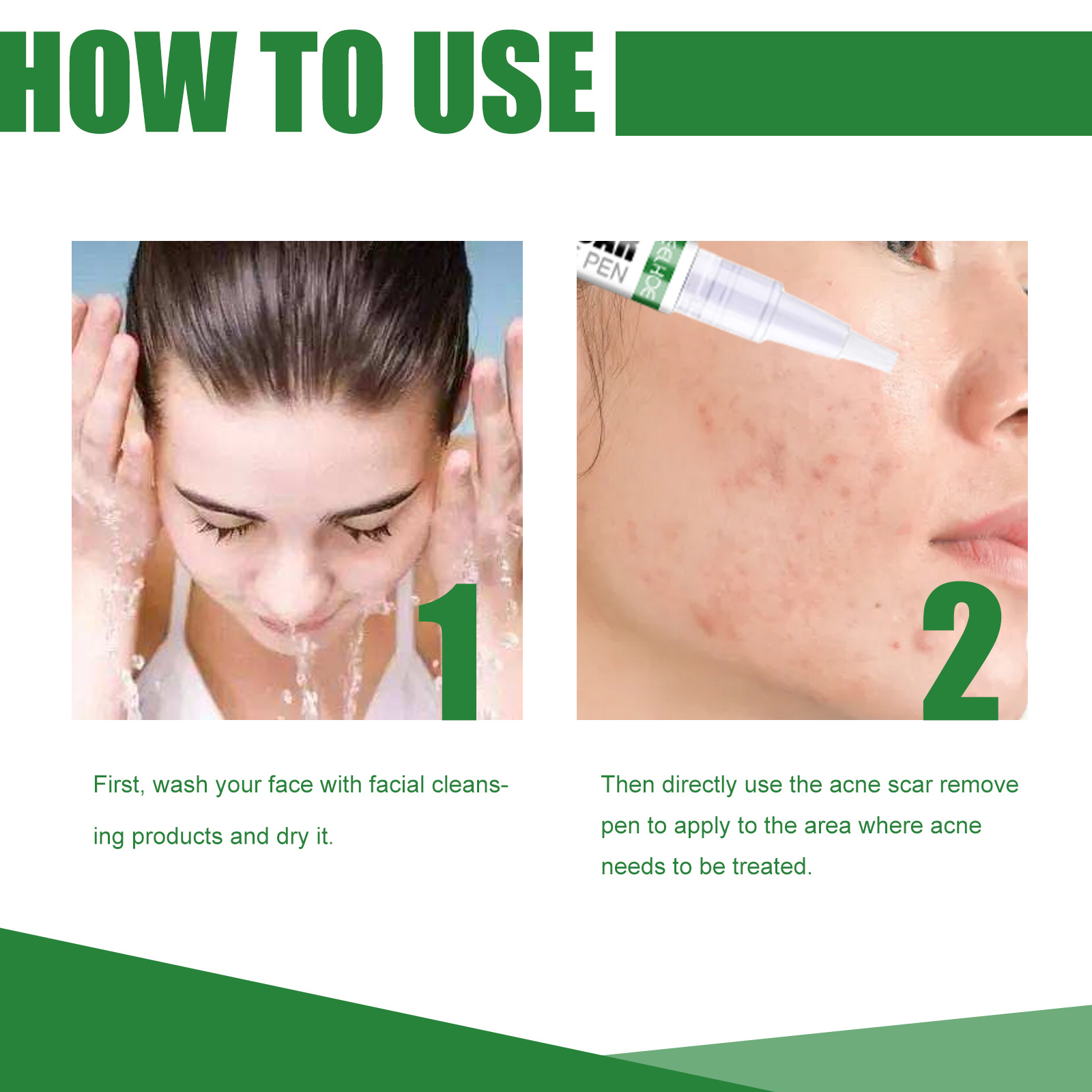 „EELHOE Ac Cleansing Pen“ valomasis pieštukas giliai valo odą, šviesina Ac randus ir atkuria užčiauptos burnos ertmės žaizdas._voghion.com