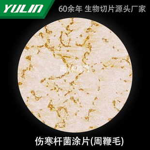 Injury Hanobacterium Coating Biological Slice Laboratory Research Microscope Slide University Teaching Microbial Scientific Research