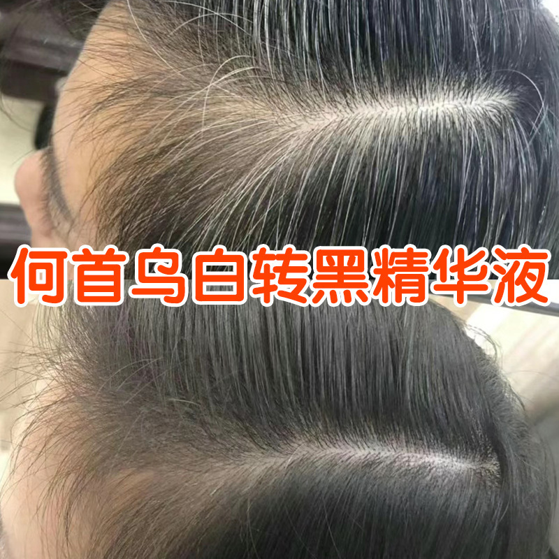 白髪から黒髪へ導く白髪黒髪美容液、ヘアケア・抜け毛防止・育毛美容液、黒髪美容液|undefined