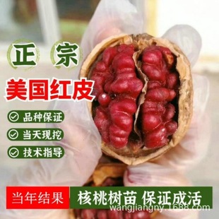 �Ͼ����Ҙ�޽ӱ������¼t�º��Ҙ��缈Ƥ�����ϱ����Nֲ����Y��