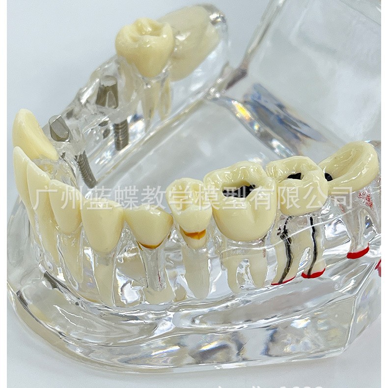 ͸��ȫ�ڲ�����ģ��ҽѧ��ѧ�ۺϲ�������������ǻ��ҽ����ͨģ��