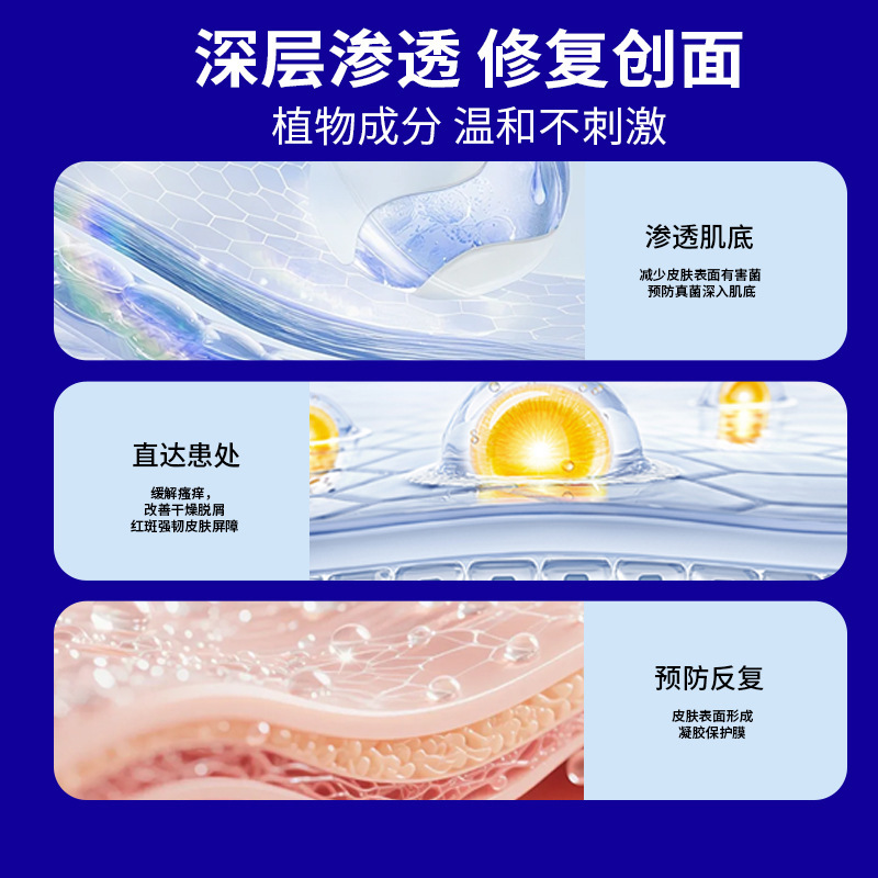 厂家批发炉甘石药膏50g/瓶外用皮肤止痒膏护理膏抖音快手一件代发|undefined