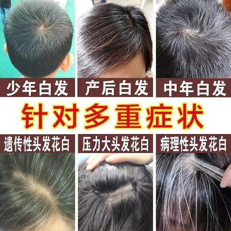 何首乌白转黑精华液白发转黑发营养液滋养毛囊养发护发防脱育发液|undefined