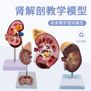 人体肾解剖模型肾脏泌尿系统2倍放大肾脏肾上腺结构 病变肾脏模型-阿里巴巴