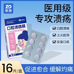 振徳口腔潰瘍は口に火をつける口腔潰瘍の保護と補助治療に適している