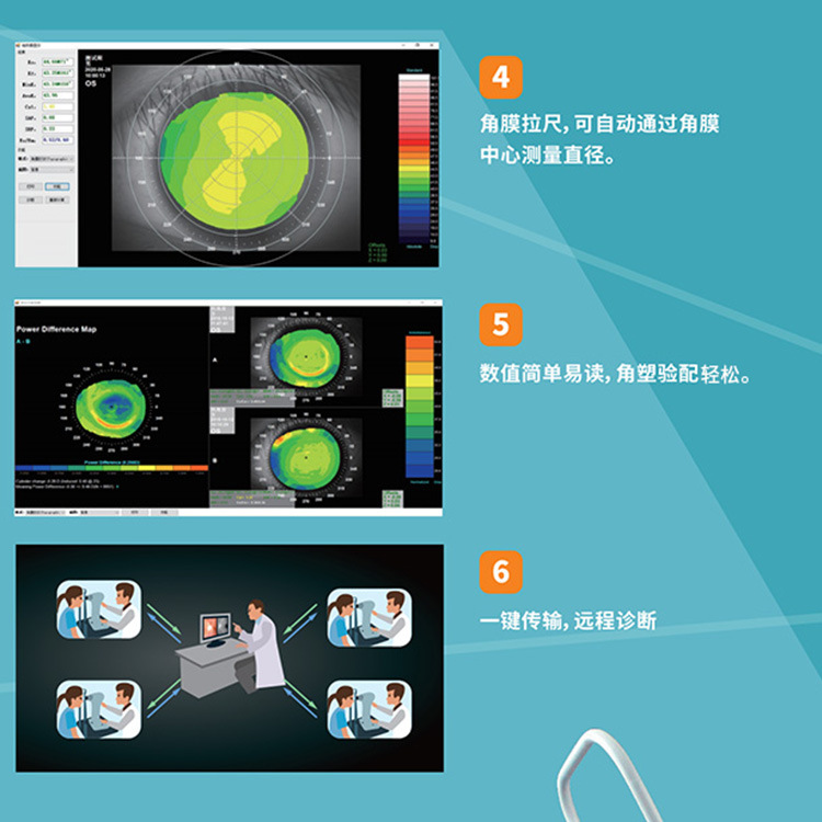 CT-6��Ĥ����ͼ&mdash;&mdash; �Զ���Ĥ���� ���۴�CT-6��Ĥ����ͼ