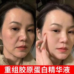 ヒアルロン酸はコラーゲンの精華液を再編成してしわの薄い細い紋様を引き締めて水を補って薄いしわの顔の原液を保湿します。