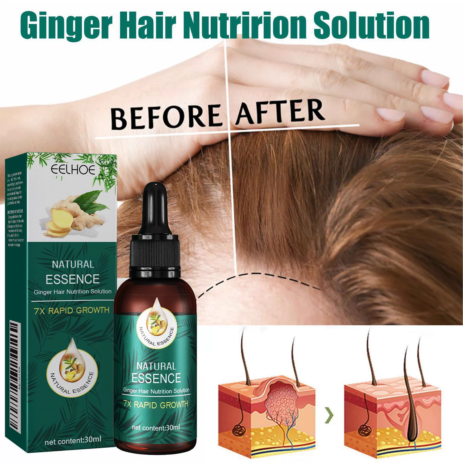 EELHOE Эфирное масло для ухода за волосами Имбирь