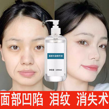 �沿�SӯҺ���I���~�^̫�Ѩ��͹���ޏ�M���y�����o�¾��AҺ