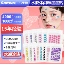ACNE�������Ƕ����N40��ˮ�z�w��ͨ�ɐ۷۴����W�N���w�W�۶����N