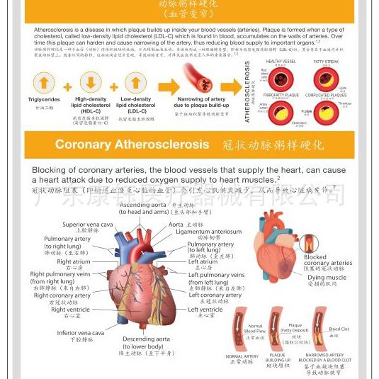 Arteriosklerosis Cina dan Inggris 23