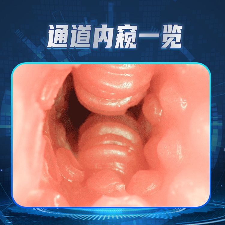 详情图