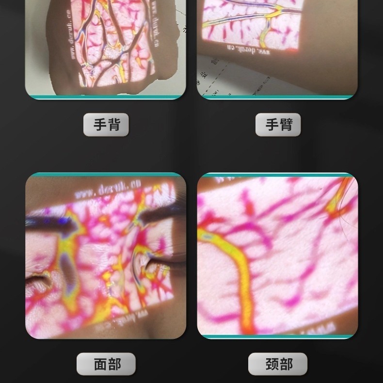 対外貿易専用血管現像器静脈血管検索器現像器静脈表示器充電帯スクリーン投影|undefined
