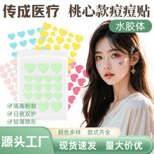 �羳�S�����l���Ŀͨ���β�ɫ�����N���ˮ�z�w�غ��ڶ��N