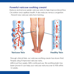 South Moon 靜脈修護膏 減少蜘蛛靜脈疏通脈絡平曲張舒緩腫脹疼痛