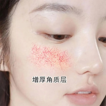 �۲������ޏ͸�ԭ�tȥ���tѪ�z�ޏ����м��澏�aˮ���AҺ