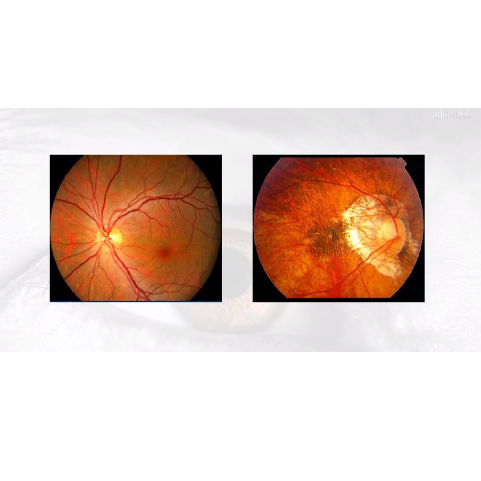 ���ӽ�չ���� �γ�����