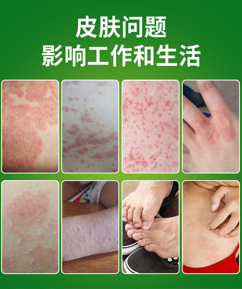 Shennong Baicao Skin Cream Herbal Ointment 20g External Use for Hand Care quality and texture