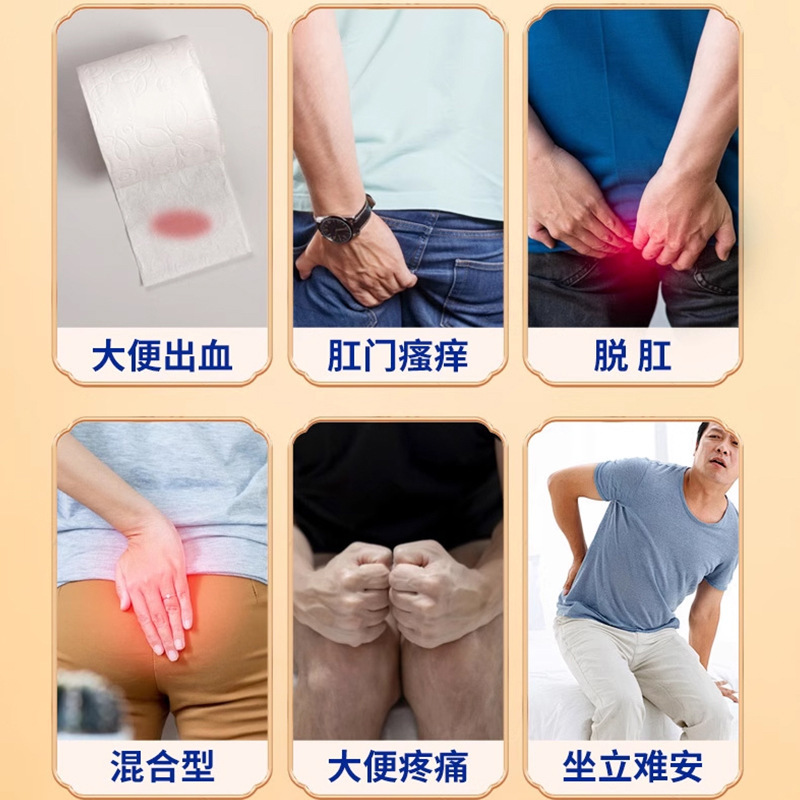 肛門周囲ケア抗菌ジェル痔による不快感外用健康ケア軟膏座りがちな腫れと痛みを和らげる外用健康ケアパッチ|undefined