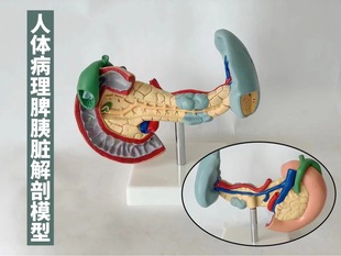 Pathological specimens of pancreatic and spleen, liver and gallbladder, and pancreas, liver and gallbladder, human organ anatomy teaching model