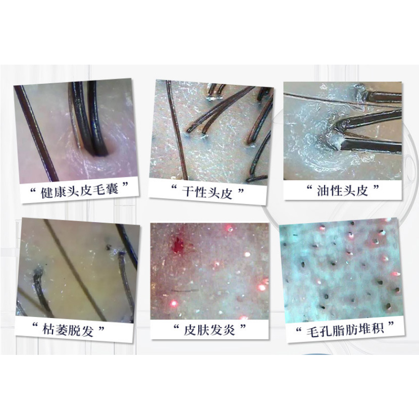 Detector de piel de cuero cabelludo inalámbrico Archivo registro información del cliente folículo pelo detector de piel centro de cuidado conexión Wifi