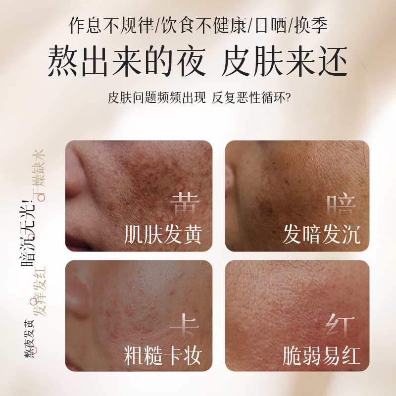 Loción corporal suave, hidratación, hidratación no pegajosa, nutrimiento, hidratación, relajación y humidificación de la piel, fabricación de modelos de invierno y otoño.