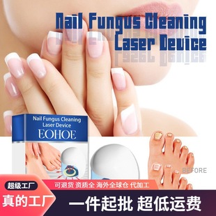 EOHOE Nail Care Instrument for Repair and Thickening of Onychomycosis Nail Relief and Nail Cleaning and Care Instrument for Nail Inlay