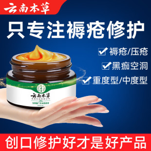 ��������ϱ����쯏��Ƥ�w���ڂ��Ϡ����������L���Դ������o����