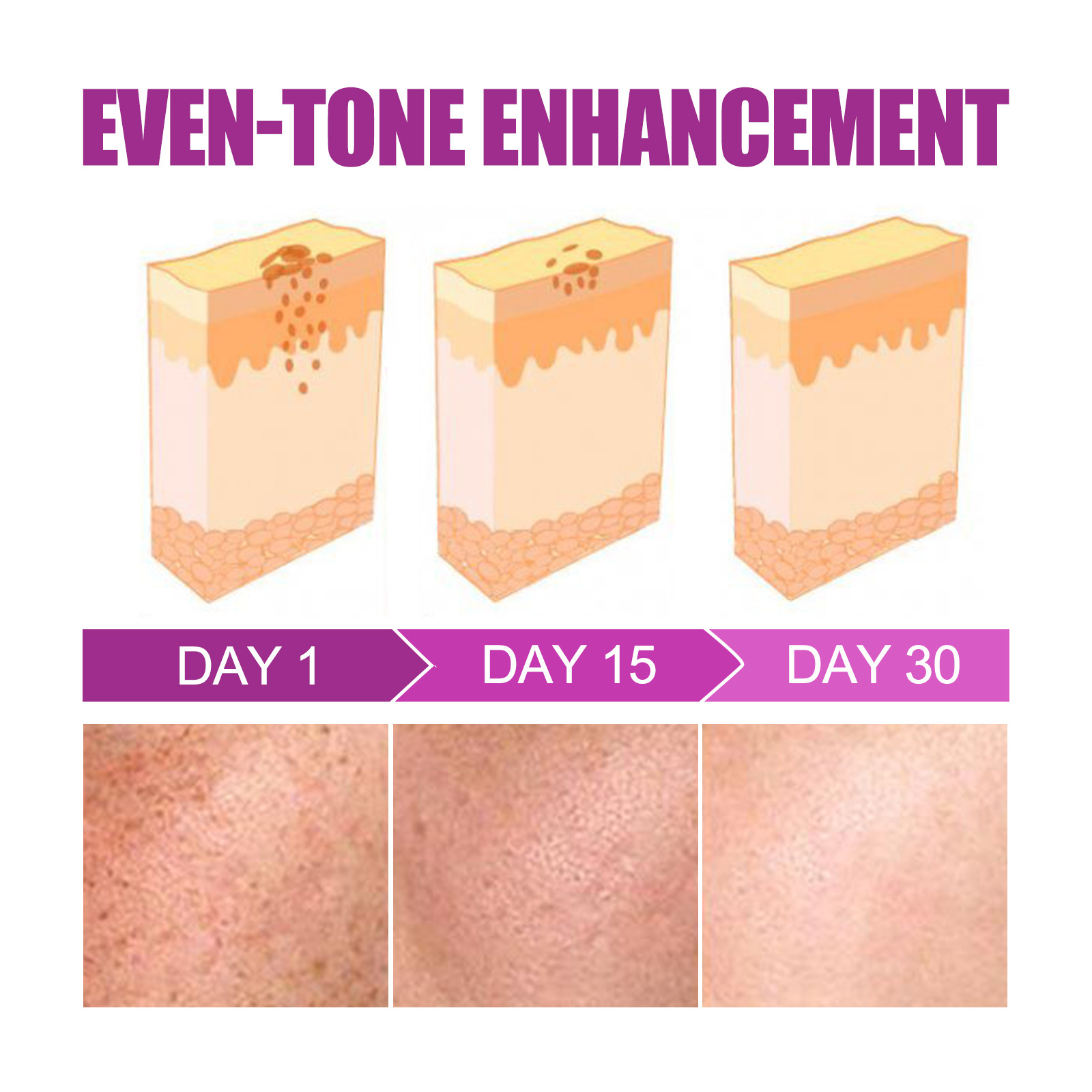 OUHOE krema za učvrstitev kože za pazduhe, komolce, ten kože, melanin za posvetlitev in beljenje kože,_voghion.com