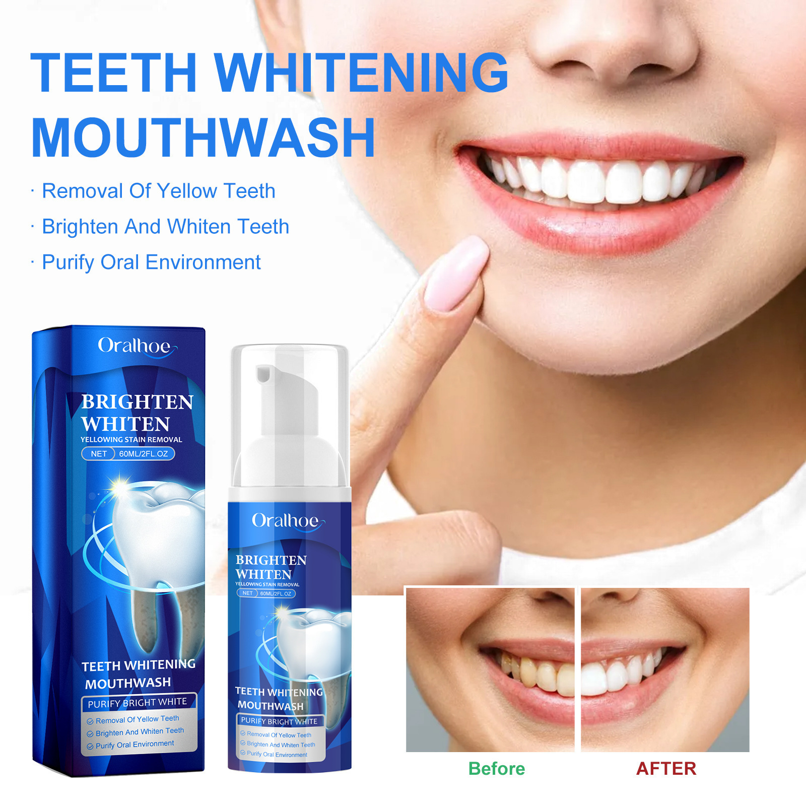 Oralhoe Teeth Cleaning Mousse Teeth Cleaning Yellow Teeth Stains Tartar Whitening Fresh Breath Oral Care