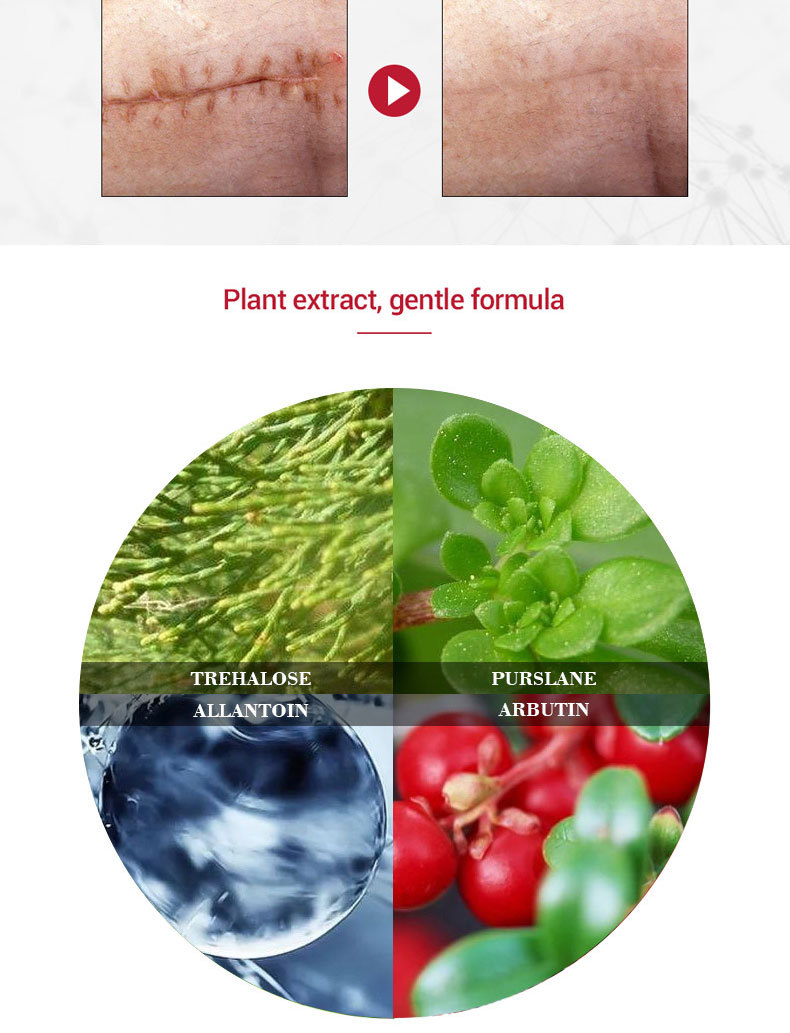 Scar Cream Image 6