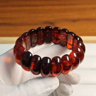 ����Ѫș��Ѫ�z��Ѫ��������Ϟ�����ִ���ֱ��ͬ��؛Դ�S��ֱ��